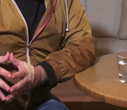 Ακόμη μια μαρτυρία συμπολίτη μας, για μόνιμα προβλήματα υγείας που απέκτησε μετά τον εμβολιασμό